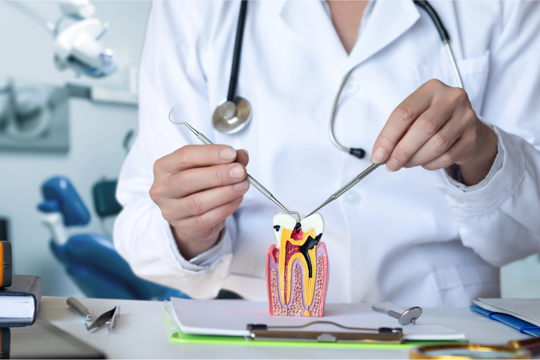 infographic showing tooth ready for a root canal