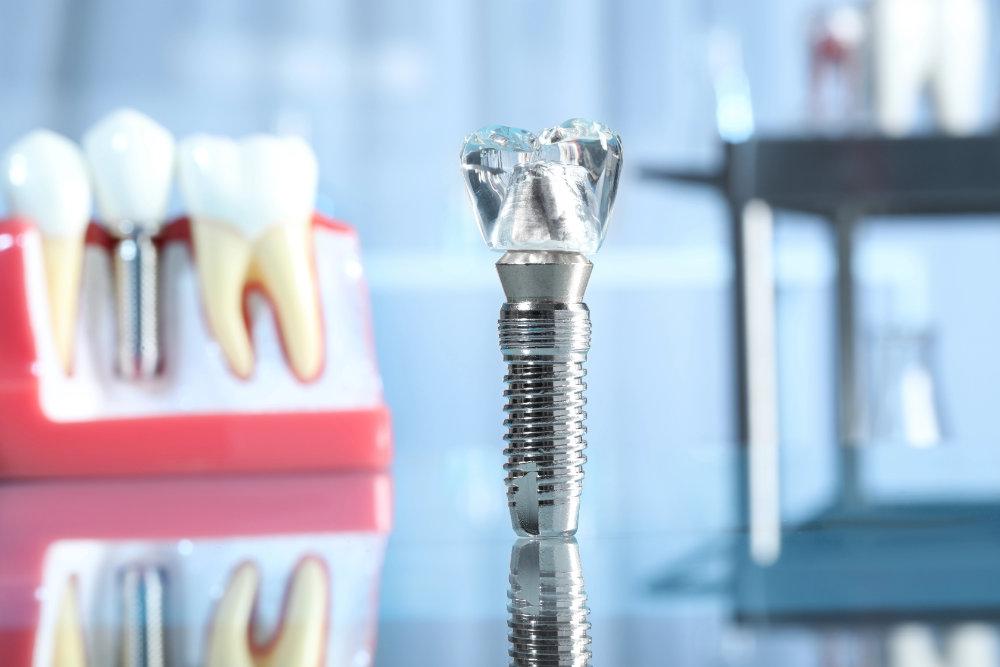A titanium dental implant with a diamond crown.