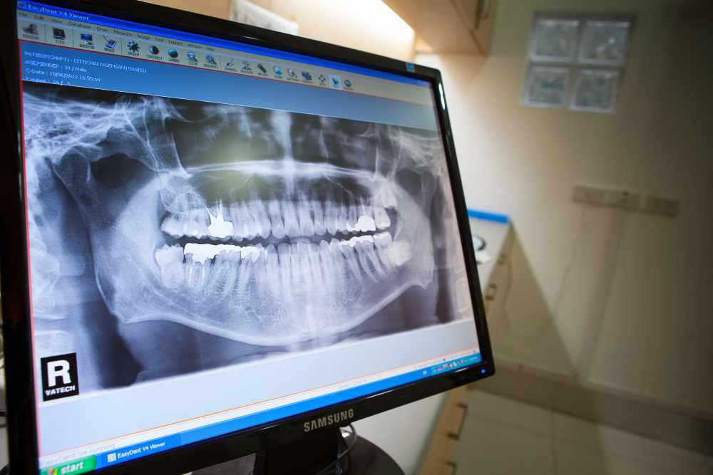 Image depicting an x-ray at Woodland Hills Dental